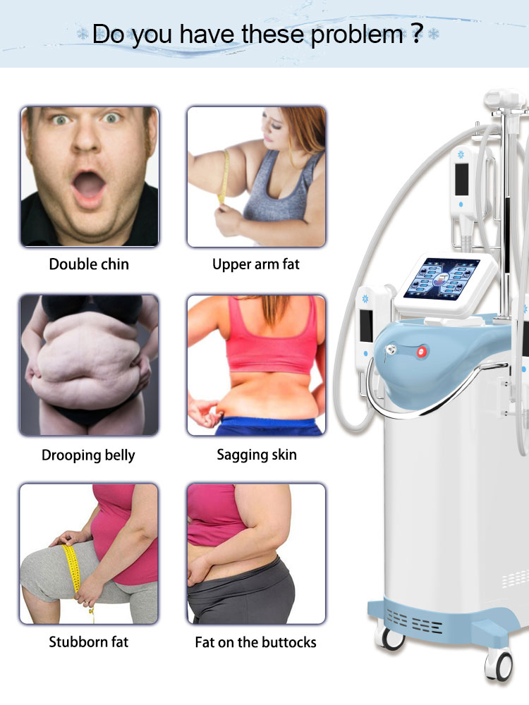 5 handles 360 cryolipolysis slimming machine